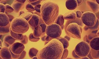 Understanding the rise of leukemia